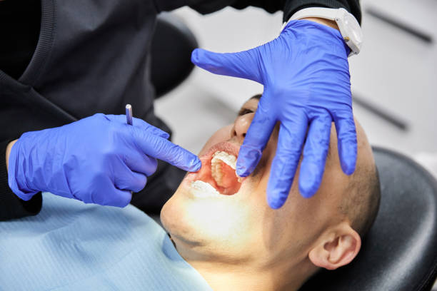 Best Broken or Chipped Tooth Repair in Unt Vernon, MO